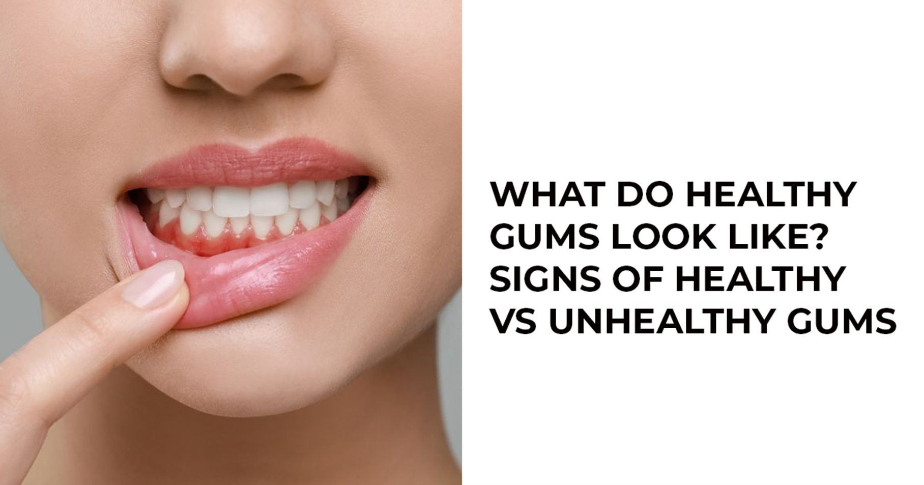 Gum Disease Treatment in Rancho Cucamonga